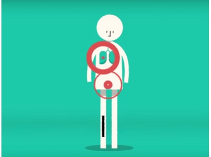 SEPSIS PREVENTION STRATEGIES